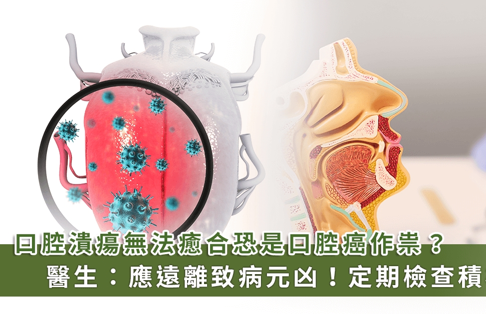 子宮肌瘤何時該手術 六大關鍵千萬別輕忽